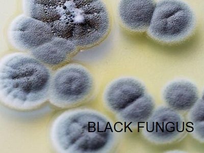 black fungus-NAI SUBEH